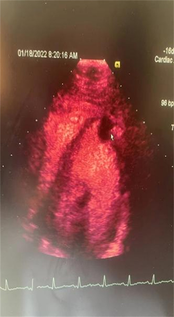 微信图片_20220517092343.jpg 微信图片_20220517092343.jpg