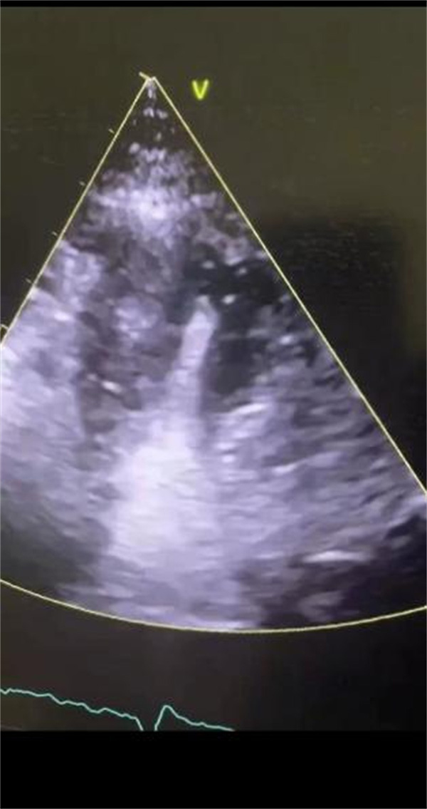 微信图片_20220517092345.jpg 微信图片_20220517092345.jpg