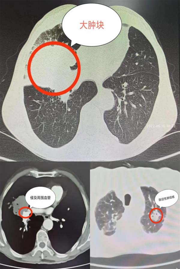 微信图片_20220726095541.jpg 微信图片_20220726095541.jpg