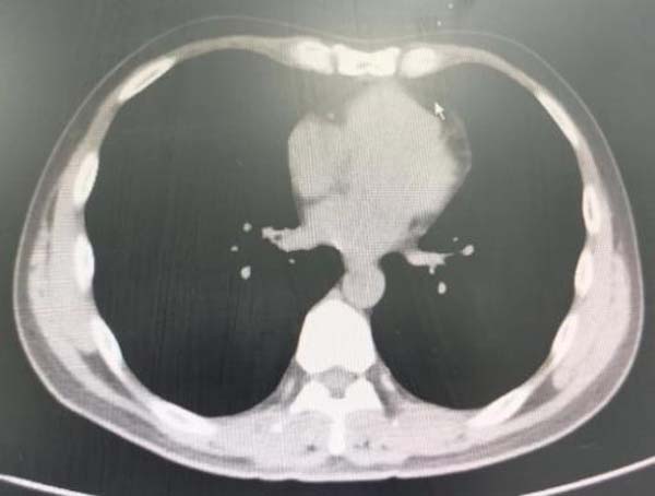 微信图片_20230313155213.jpg 微信图片_20230313155213.jpg