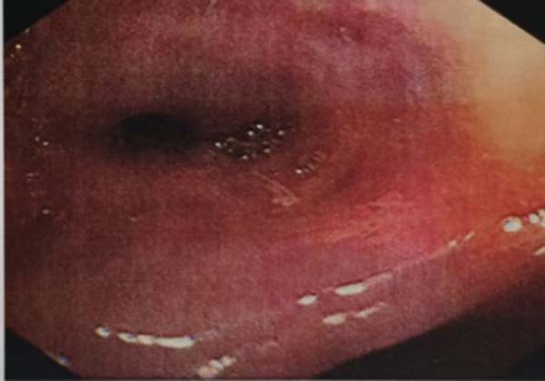 微信图片_20230313155215.jpg 微信图片_20230313155215.jpg