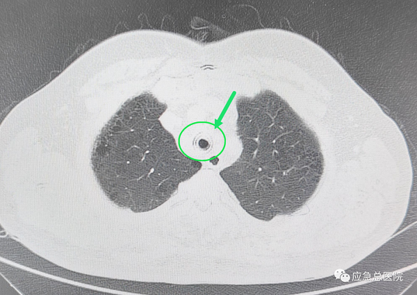 upfile 64bccbf3e4b0285e0b786553.png