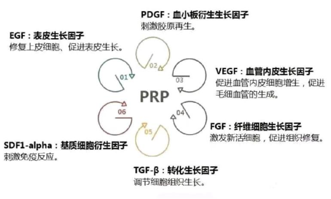 upfile